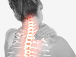 Osteocondrosis de la región cervical