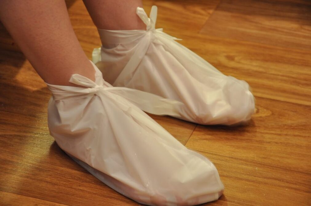 compresas para artrosis de tobillo