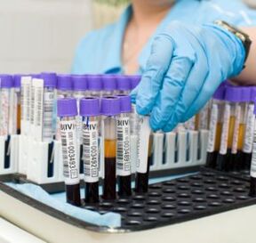 análisis de sangre para diagnosticar dolor en las articulaciones