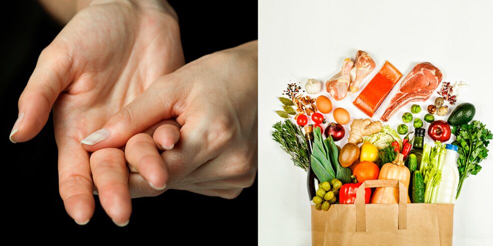 artritis gotosa de las manos y alimentos para su tratamiento