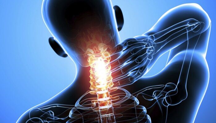 dolor en la columna cervical