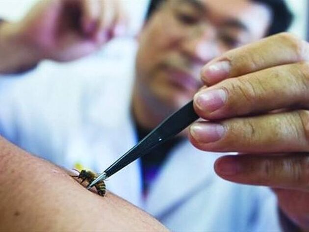 apiterapia para la osteocondrosis cervical